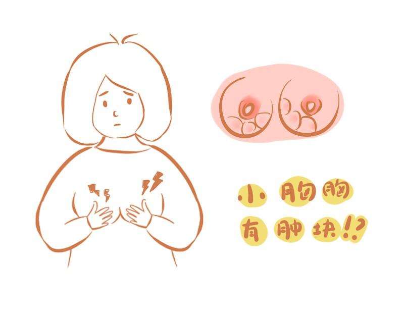 5岁女孩乳房不对称，一查却是肿瘤？做好5件事，预防乳房纤维瘤"