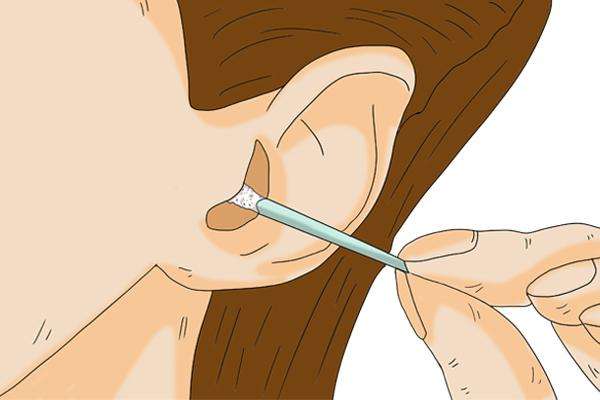 耳朵是湿耳屎是什么原因（耳朵经常有湿耳屎要提防这3类疾病）