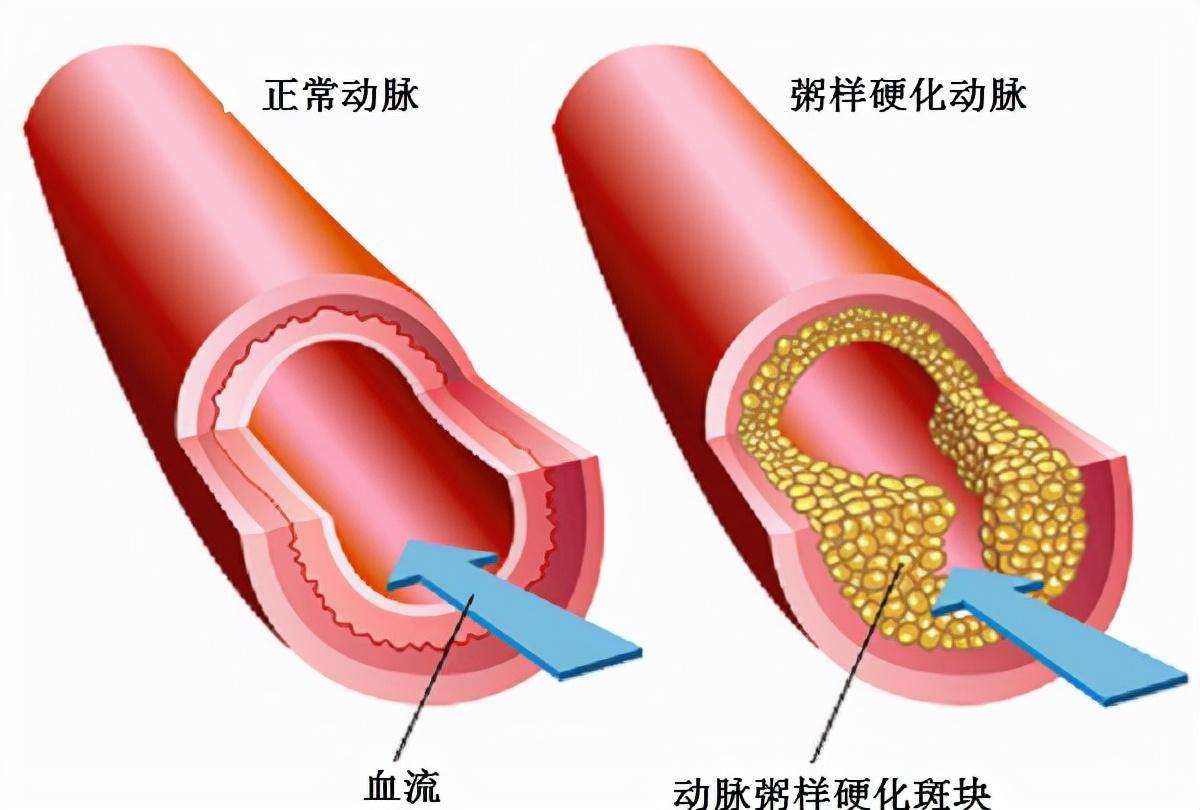 现实中咬舌真的能自尽吗（从舌的解剖学一文说清楚）